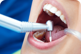 درمان های دندانپزشکی