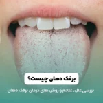 عگس برفک دهان