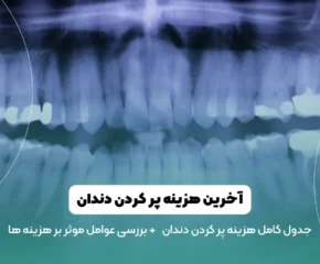 هزینه پر کردن دندان در سال 1403