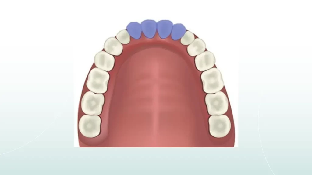 عکس دندان ثنایا 