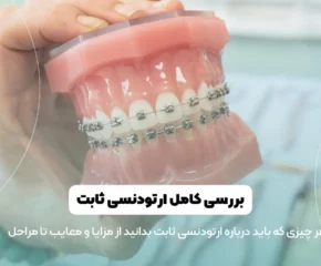 عکس ارتودنسی ثابت