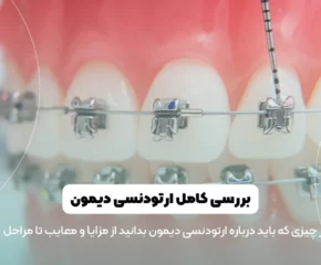 تصویر شاخص ارتودنسی دیمون