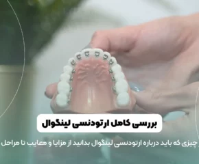 ارتودنسی لینگوال