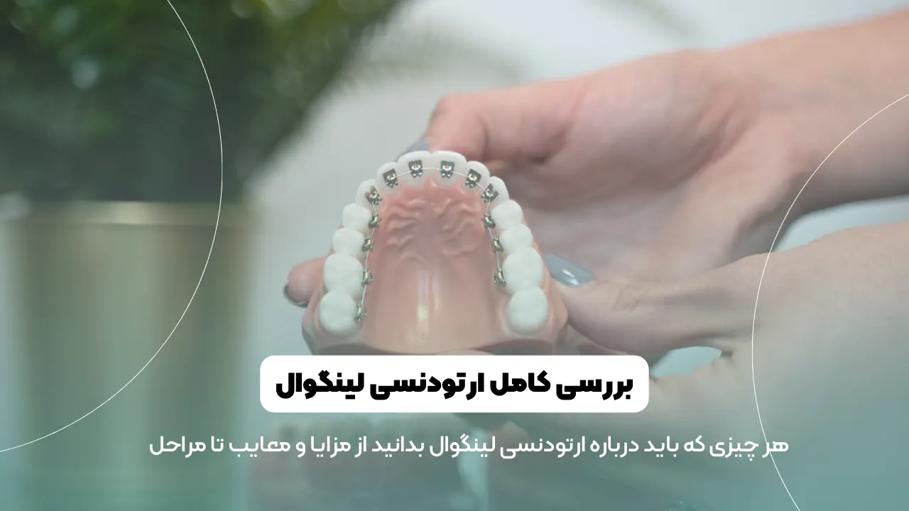 ارتودنسی لینگوال