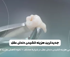 هزینه کشیدن دندان عقل شاخص