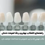 راهنمای انتخاب بهترین رنگ لمینت دندان شاخص