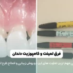 فرق لمینت و کامپوزیت شاخص