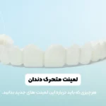 لمینت متحرک دندان شاخص