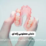 دندان مصنوعی ژله ای شاخص