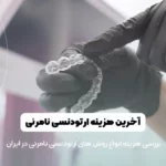 هزینه ارتودنسی نامرئی