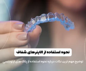 نحوه استفاده از الاینرهای شفاف ارتودنسی شاخص