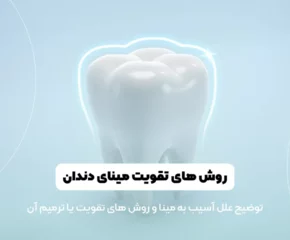 تقویت مینای دندان شاخص