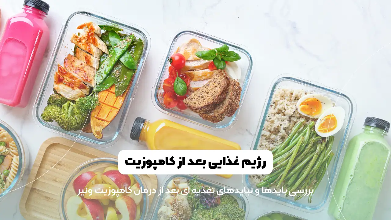 رژیم غذایی بعد از کامپوزیت دندان شاخص