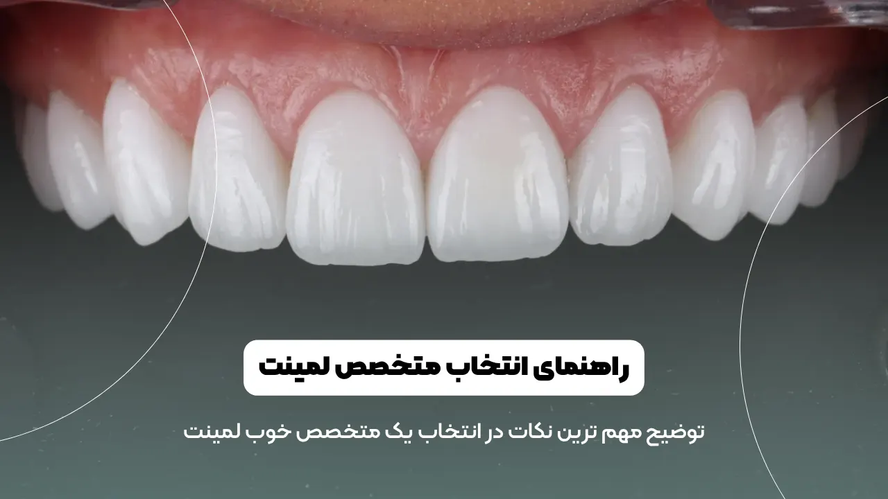 بهترین متخصص لمینت دندان شاخص