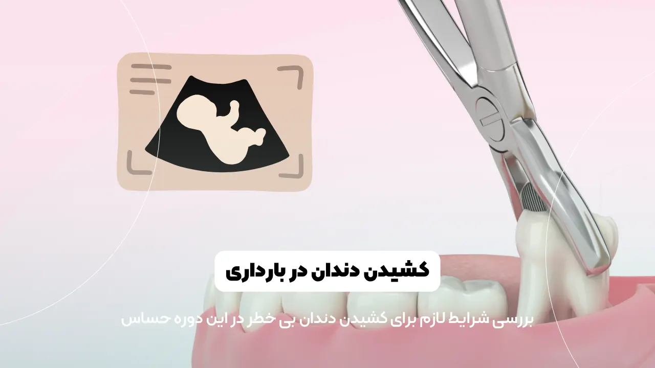 کشیدن دندان در بارداری شاخص