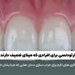 ارتودنسی برای افرادی که مینای ضعیف دارند شاخص