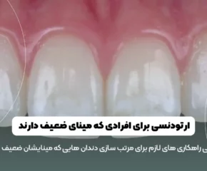 ارتودنسی برای افرادی که مینای ضعیف دارند شاخص
