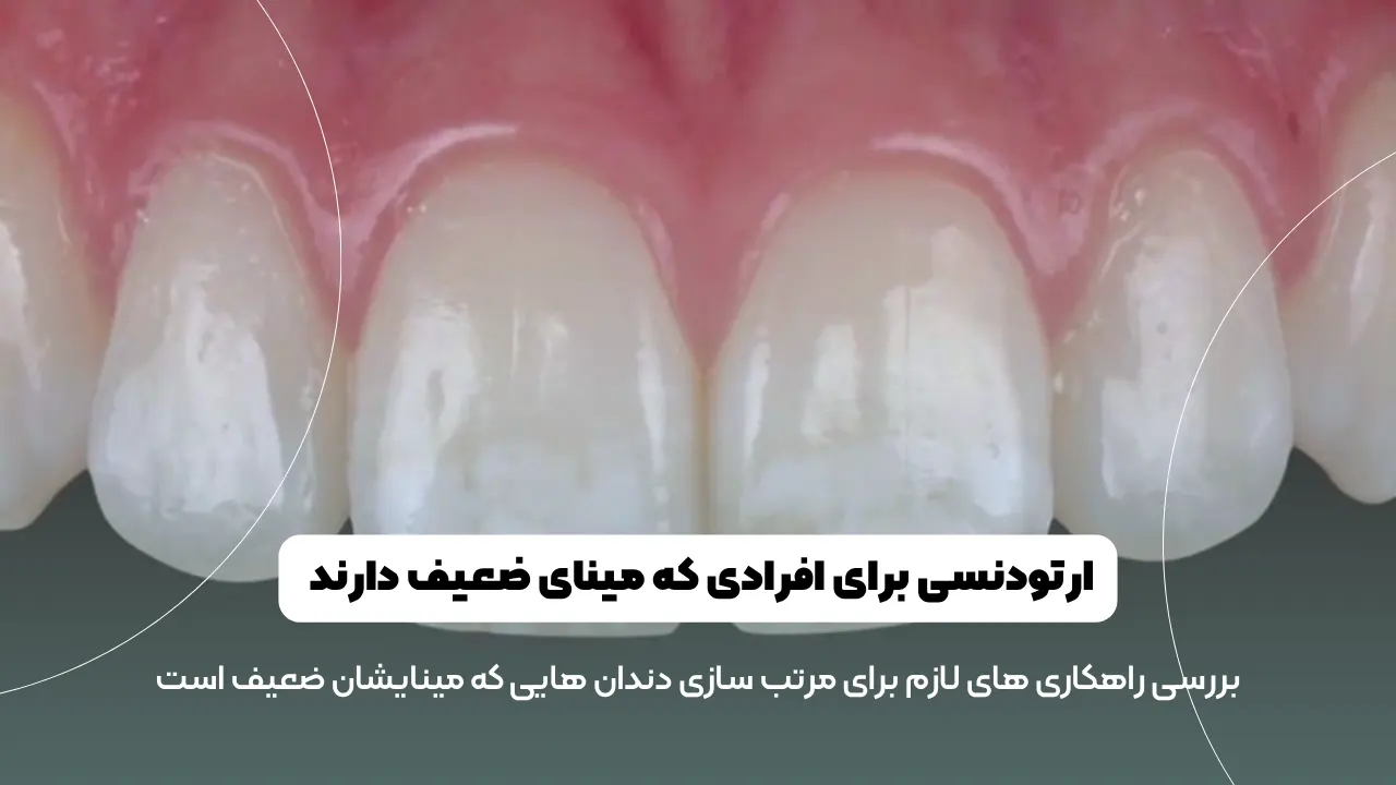 ارتودنسی برای افرادی که مینای ضعیف دارند شاخص