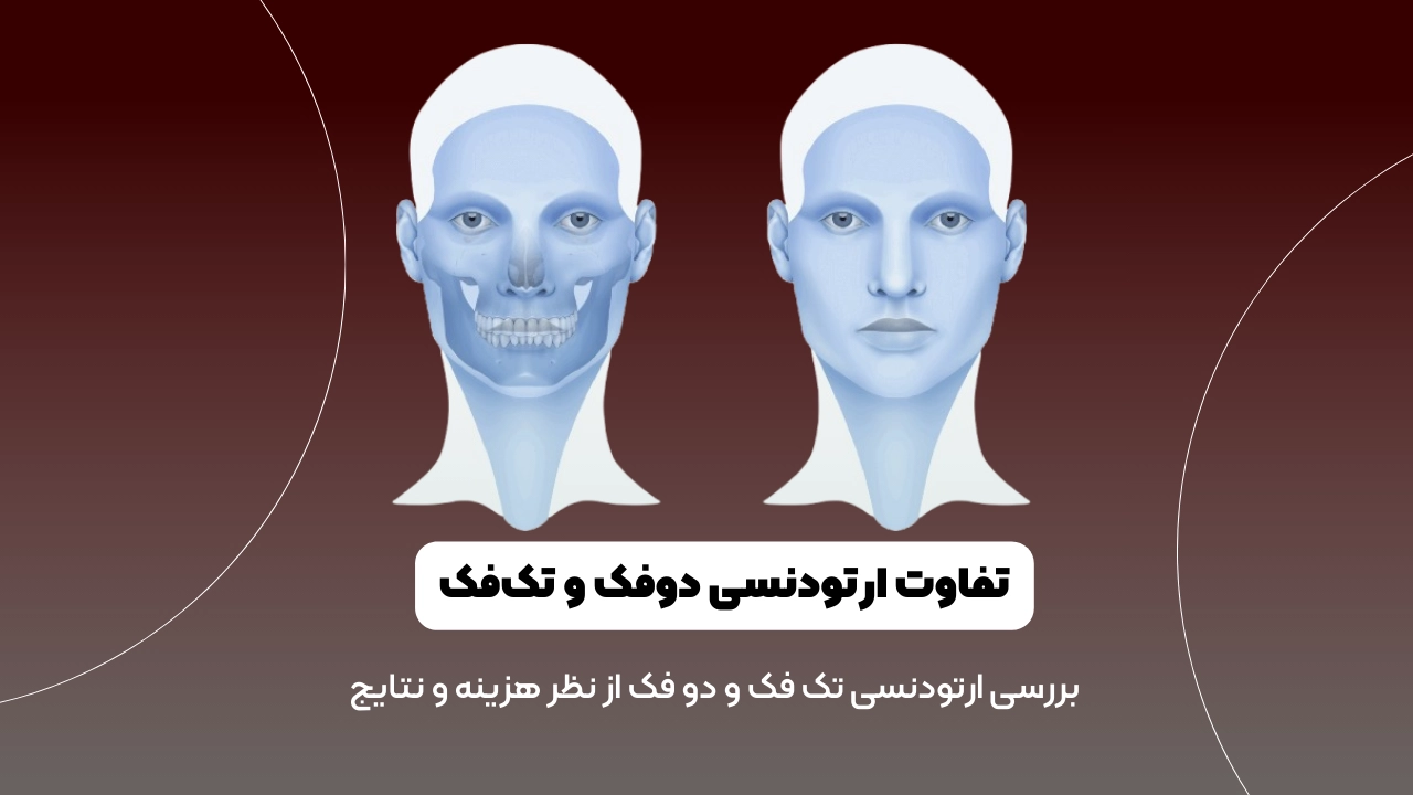 ارتودنسی تک فک شاخص