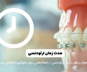 مدت زمان ارتودنسی