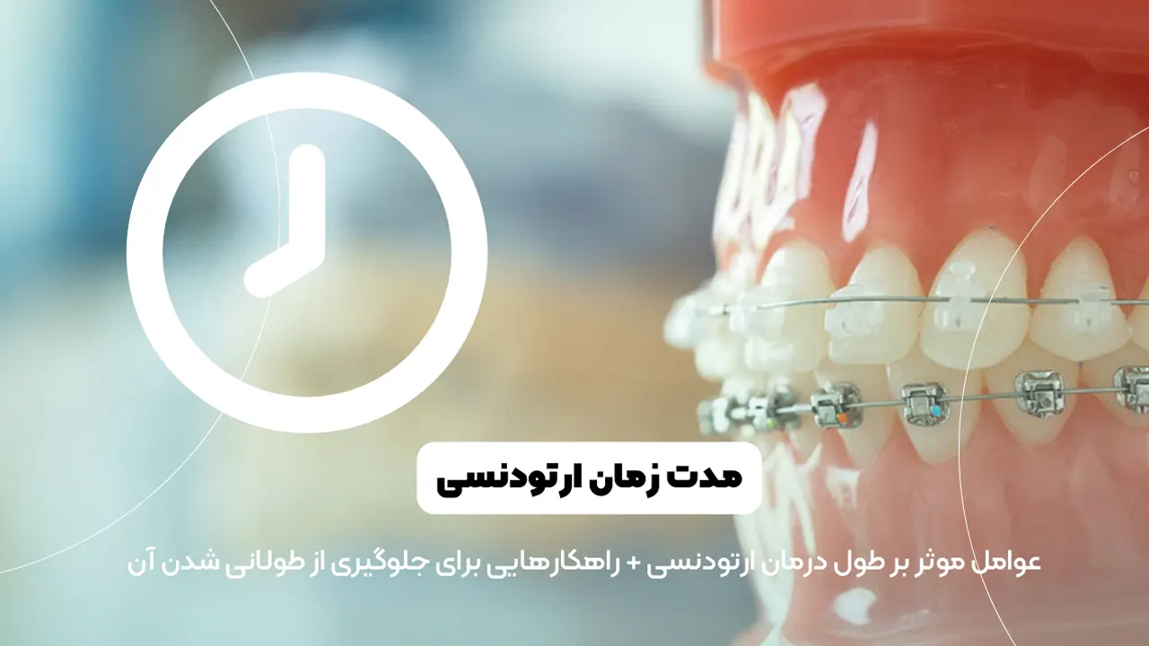 مدت زمان ارتودنسی