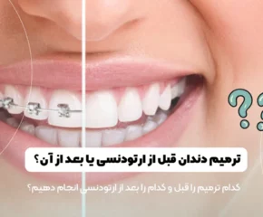ترمیم دندان قبل یا بعد از ارتودنسی