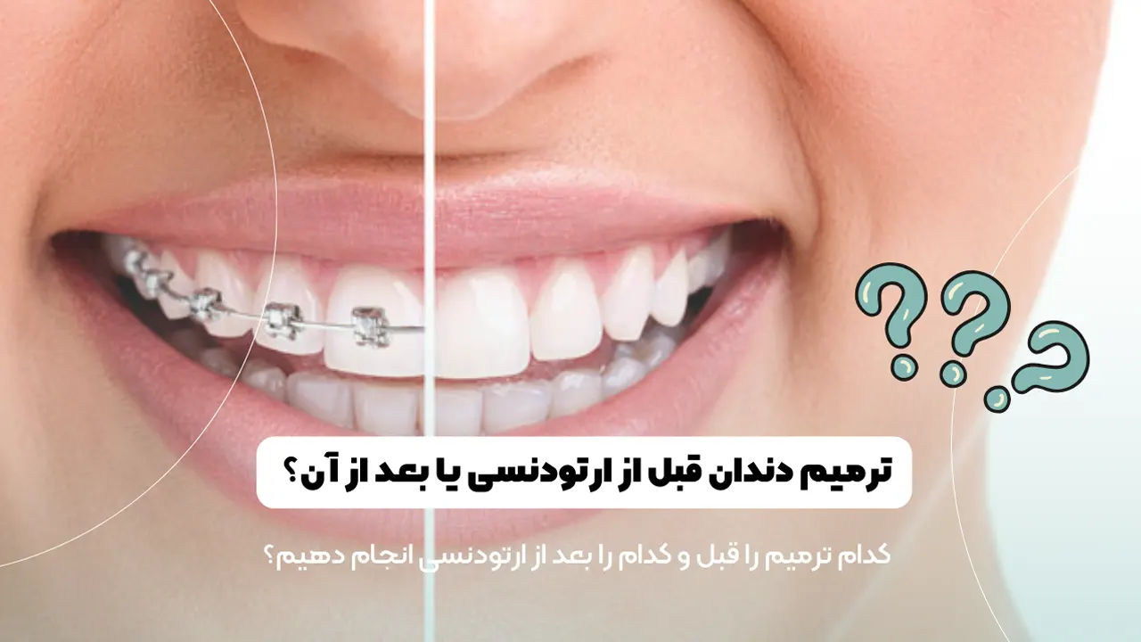 ترمیم دندان قبل یا بعد از ارتودنسی