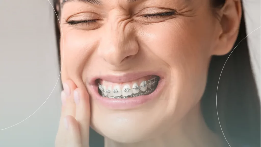 علت درد هنگام ارتودنسی