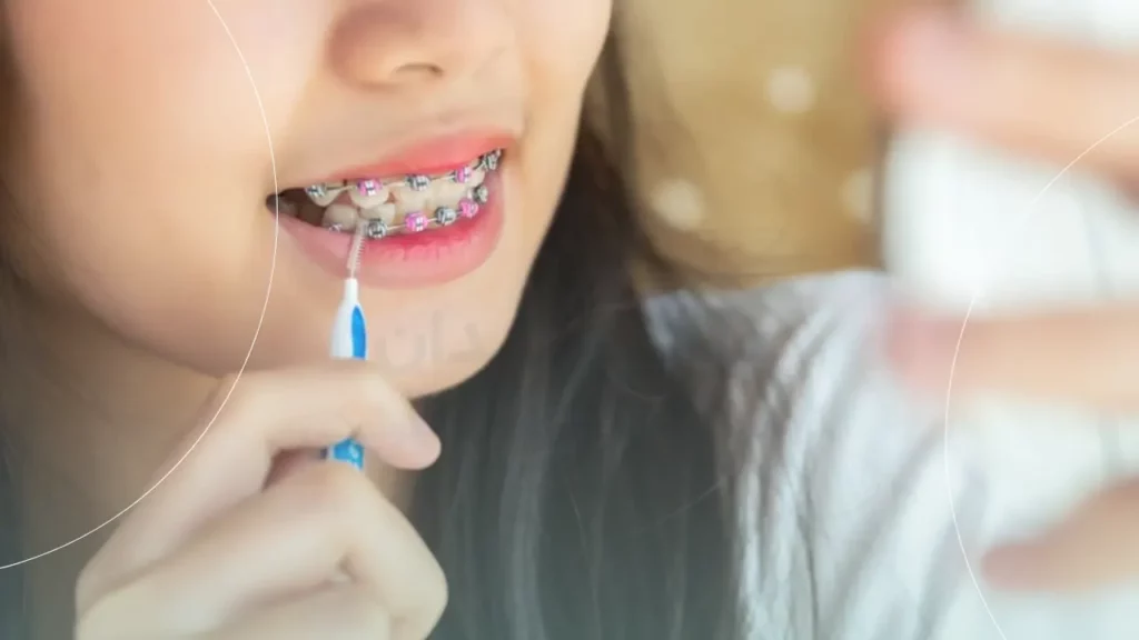 مراقبت از دستگاههای ارتودنسی