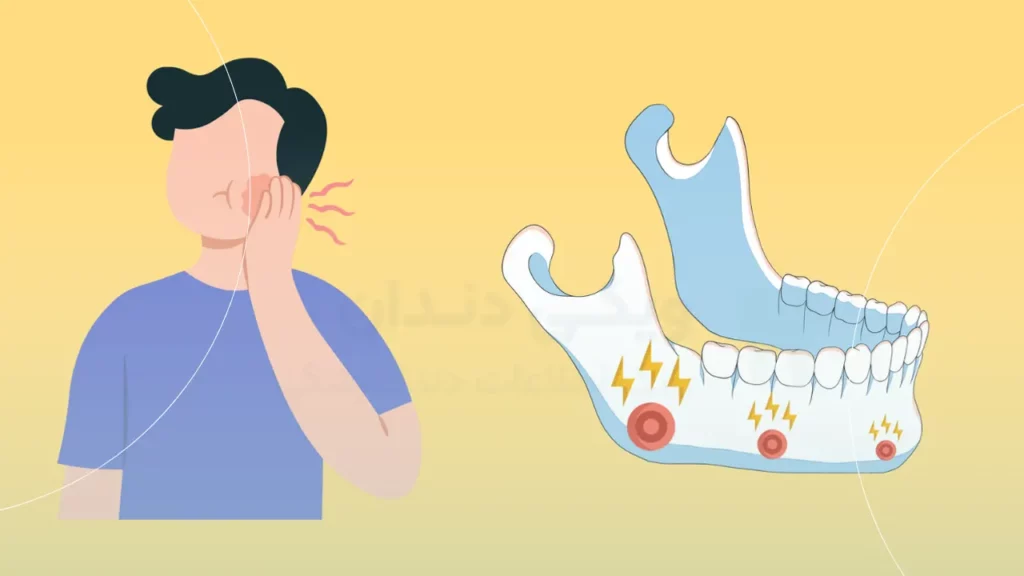 اختلال مفصل فک TMD