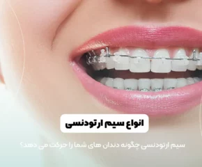 انواع سیم ارتودنسی