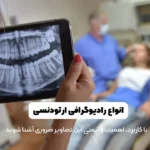 انواع رادیوگرافی ارتودنسی