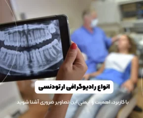 انواع رادیوگرافی ارتودنسی