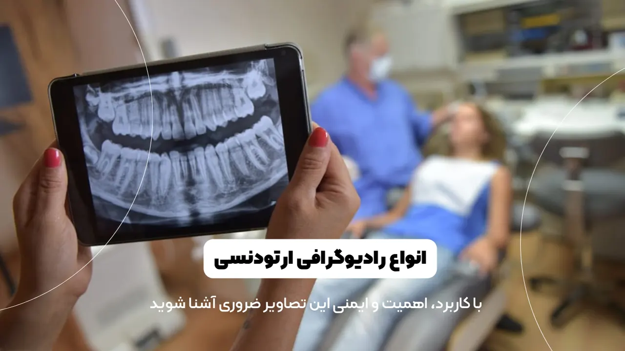 انواع رادیوگرافی ارتودنسی