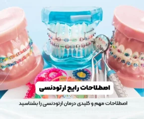 اصطلاحات رایج ارتودنسی
