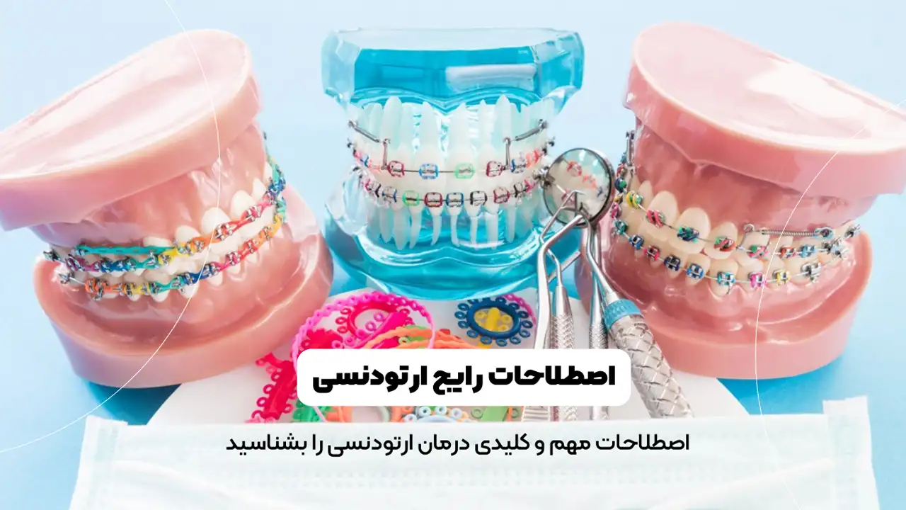 اصطلاحات رایج ارتودنسی