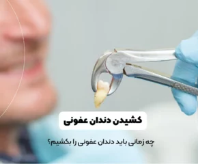 کشیدن دندان عفونی