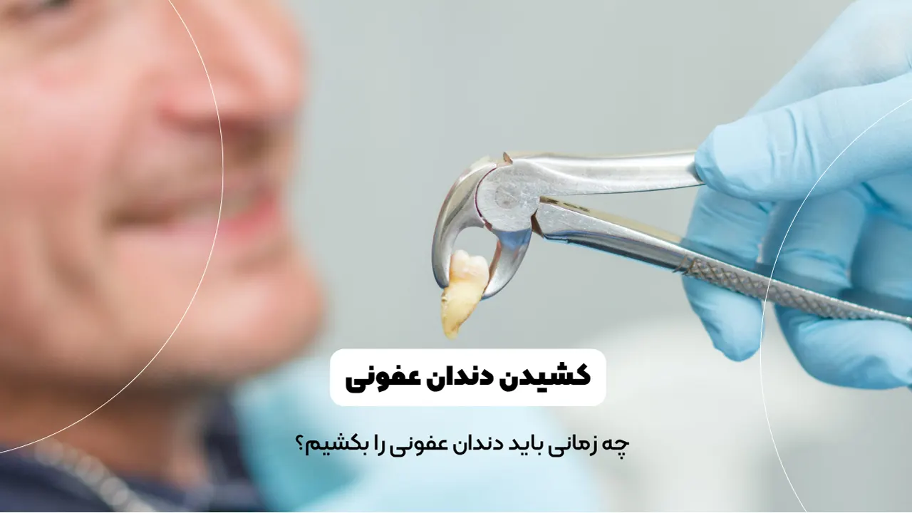 کشیدن دندان عفونی