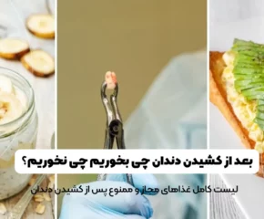 بعد از کشیدن دندان چی بخوریم چی نخوریم؟
