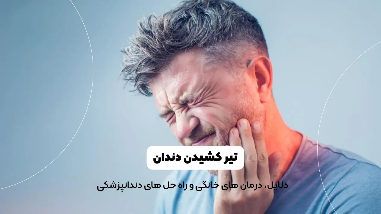 تیر کشیدن دندان