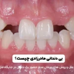 بی دندانی مادرزادی