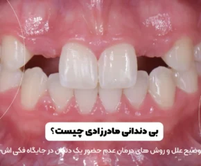 بی دندانی مادرزادی