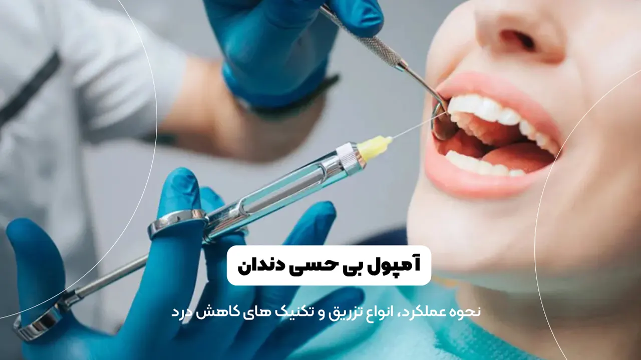 آمپول های بی حسی دندان