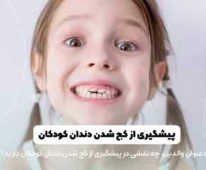پیشگیری از کج شدن دندان کودکان