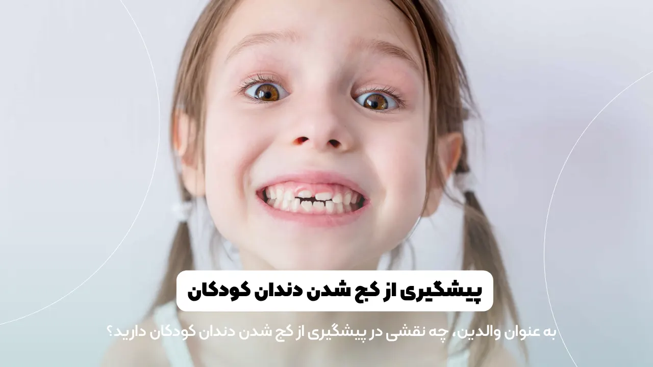 پیشگیری از کج شدن دندان کودکان