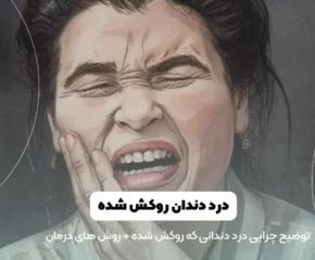 درد دندان روکش شده شاخص