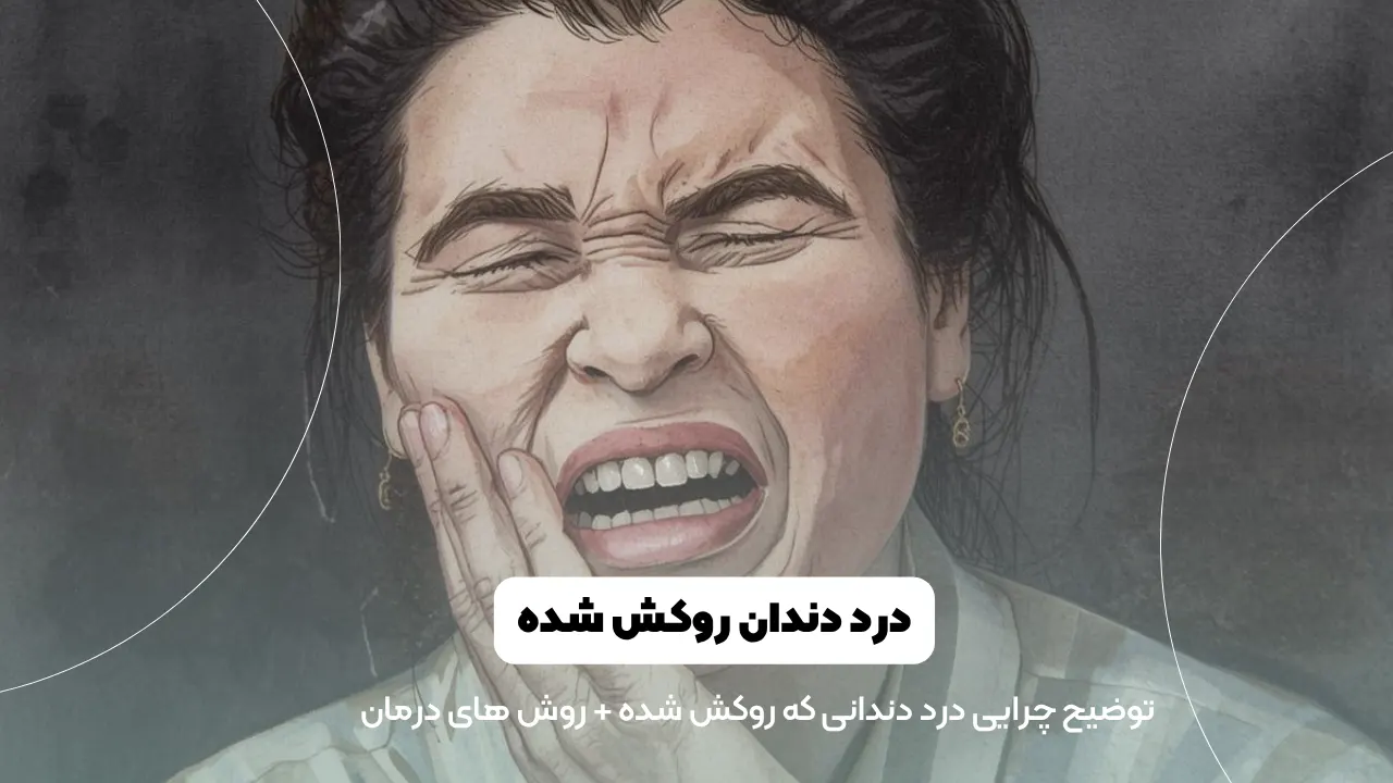 درد دندان روکش شده شاخص