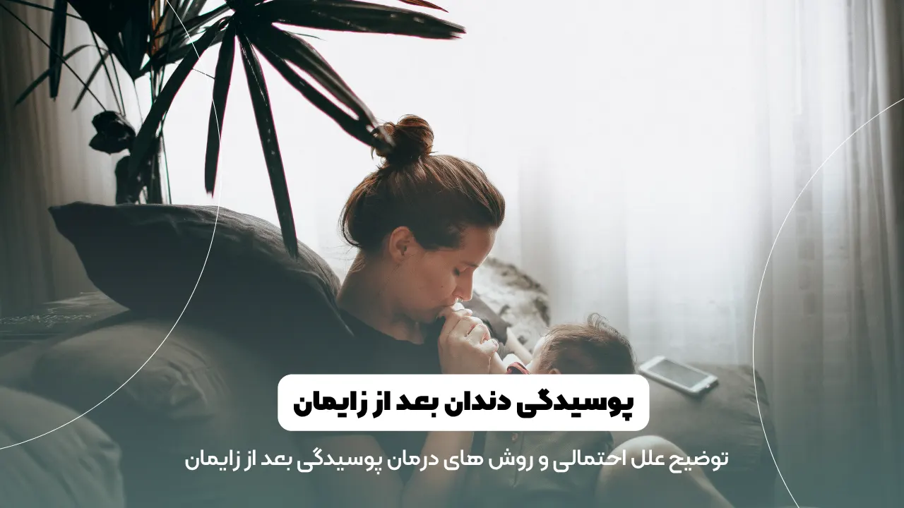 پوسیدگی دندان بعد از زایمان شاخص