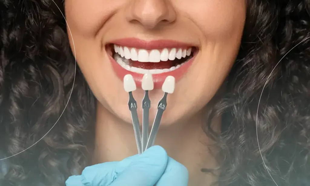 تصویر خانمی که سه رنگ لمینت دندان جلویش گرفته شده است