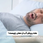 علت ریزش آب از دهان